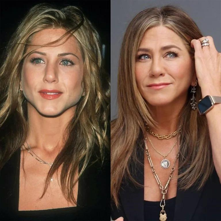 Jennifer Aniston Botox