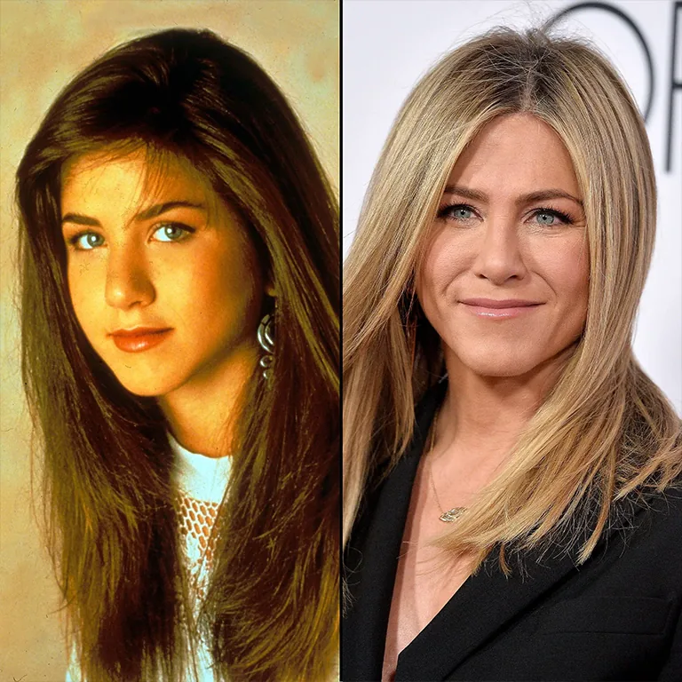 Jennifer Aniston Cheek Fillers