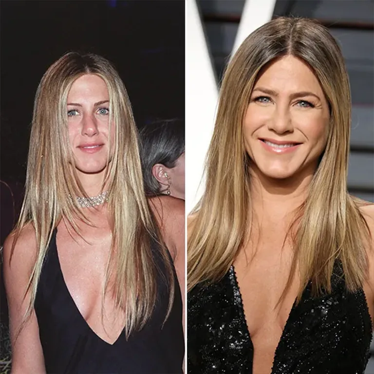 Jennifer Aniston Eyelid Surgery