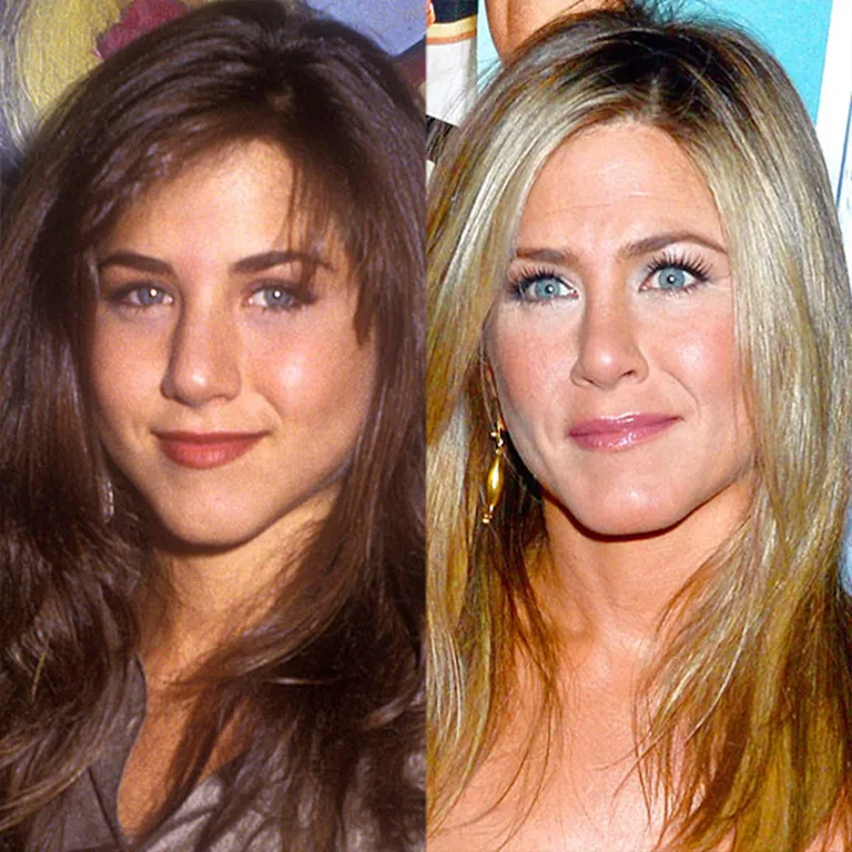 Jennifer Aniston Nose Job