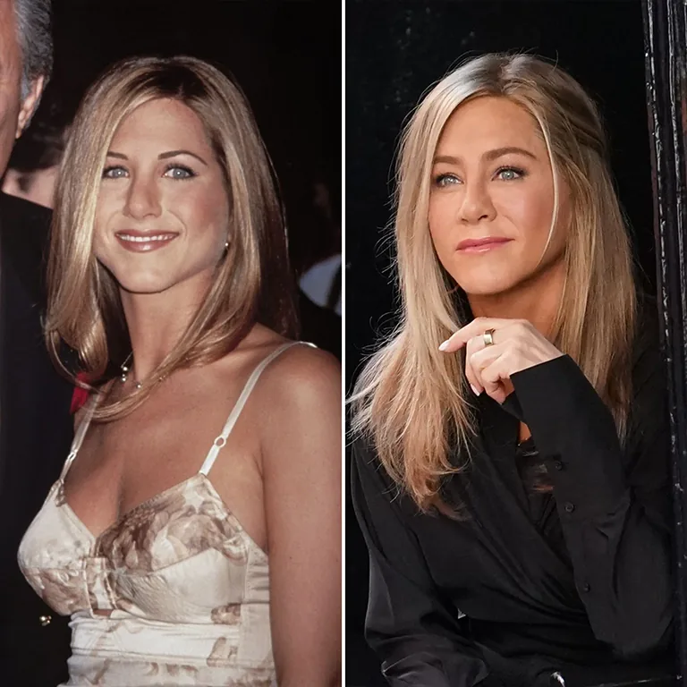 Jennifer Aniston’s Plastic Surgery Costs How Much Would It Be