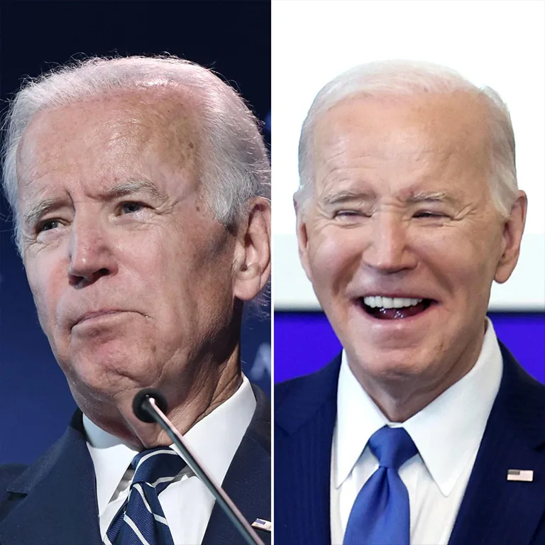 Joe Biden’s Plastic Surgery Costs
