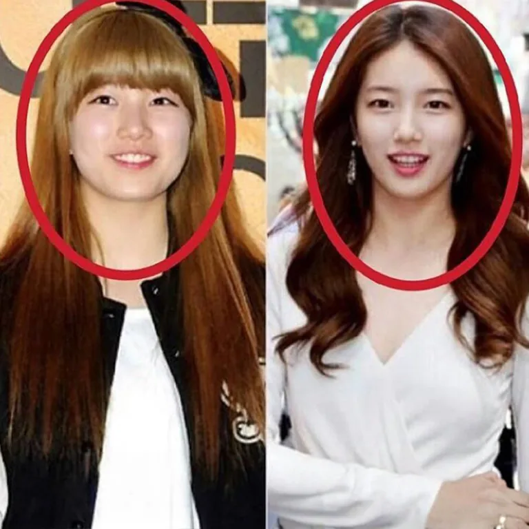 K-Pop Nose Jobs