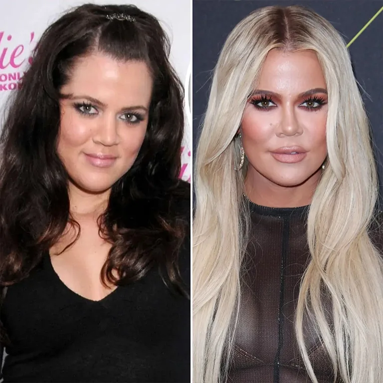Kardashians Plastic Surgery Costs