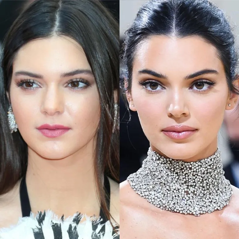 Kendall Jenner Before and After
