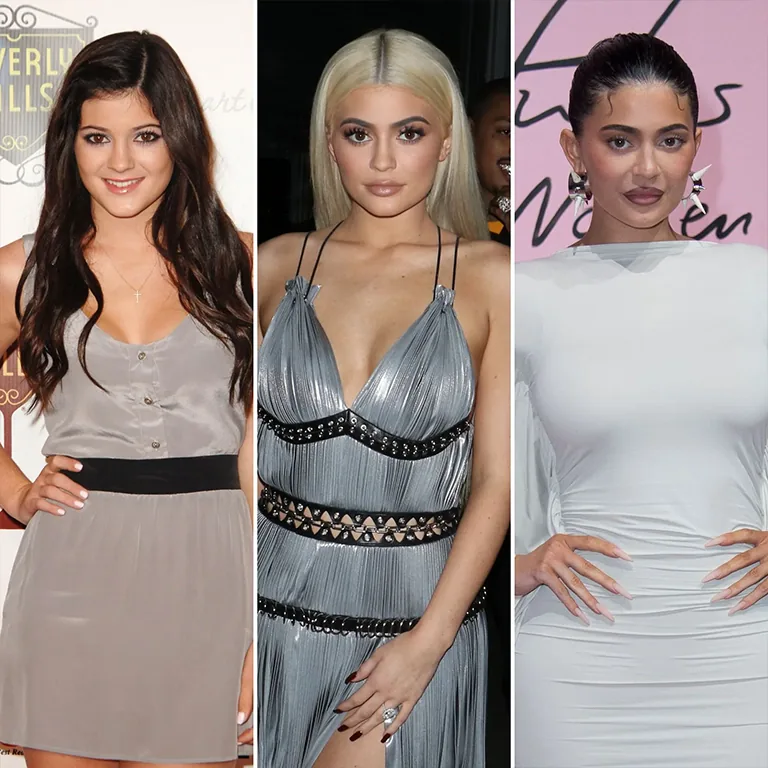 Kylie Jenner Before and After How Her Face Has Changed Over the Years