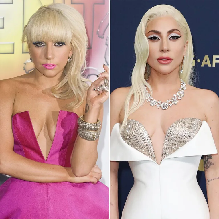 Lady Gaga Jawline Before and After