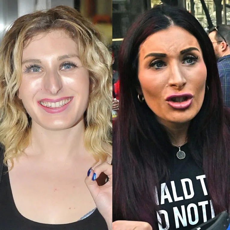 Laura Loomer Before and After