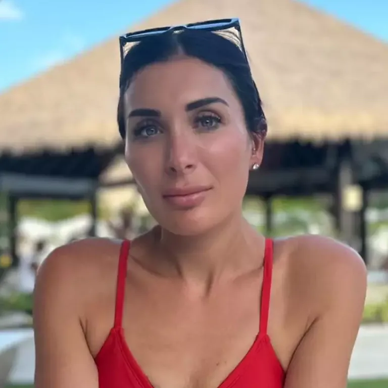 Laura Loomer Facelift Rumors