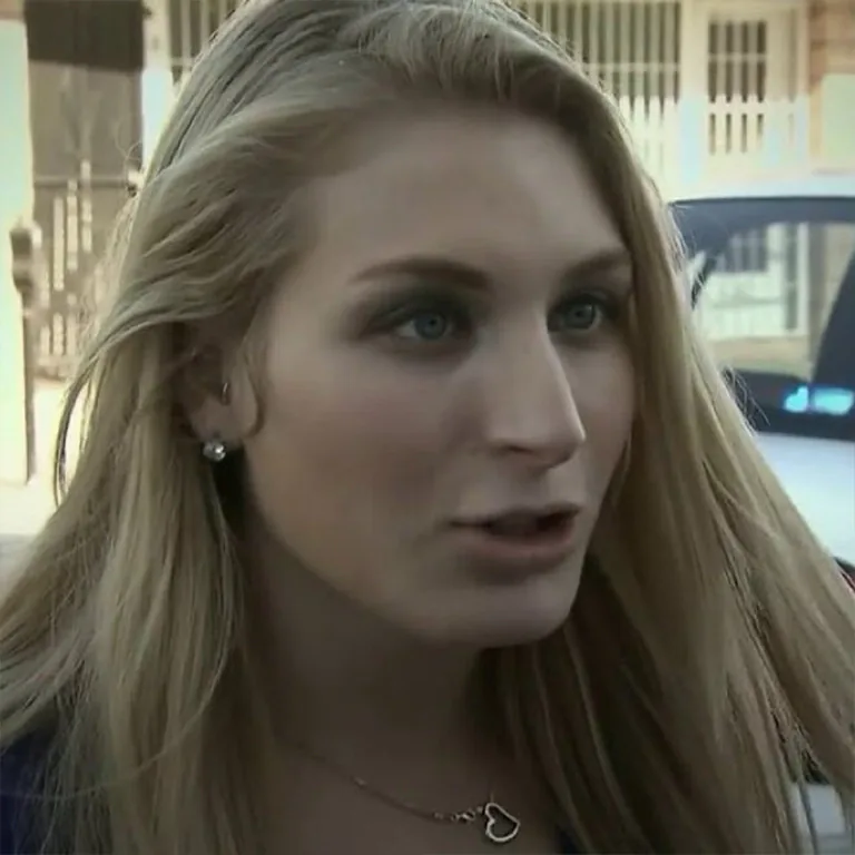 Laura Loomer Lip Fillers
