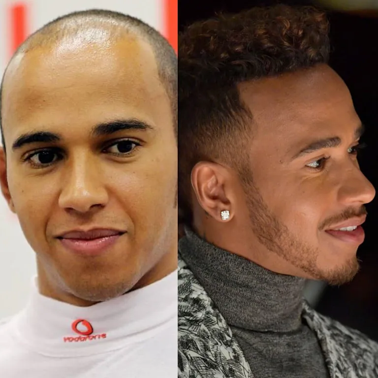 Lewis Hamilton Before and After A Visible Shift
