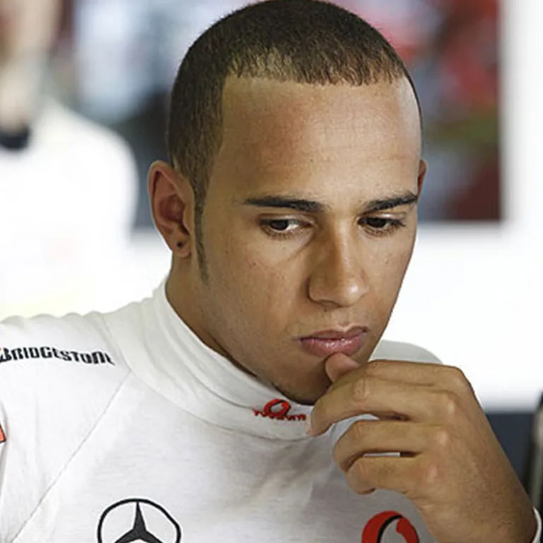 Lewis Hamilton Hairline Before and After A Closer Look