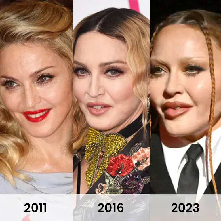 Madonna Aesthetich