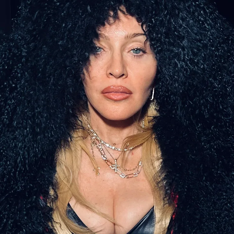 Madonna Botox