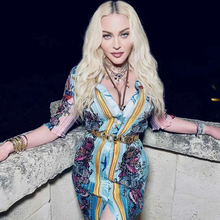Madonna Cheek Fillers