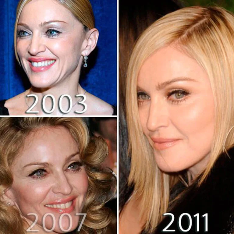 Madonna Most Dramatic Beauty Transformations Over Time