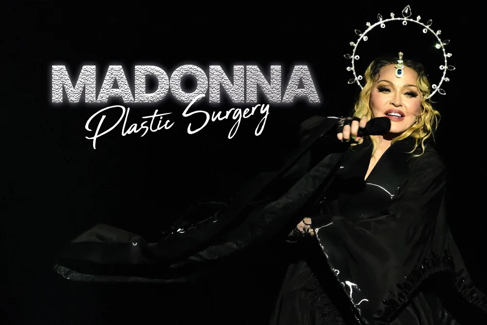 Madonna Plastic Surgery