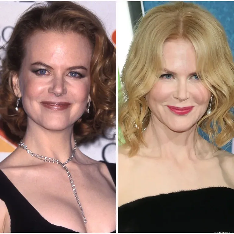Nicole Kidman’s Skin Secrets