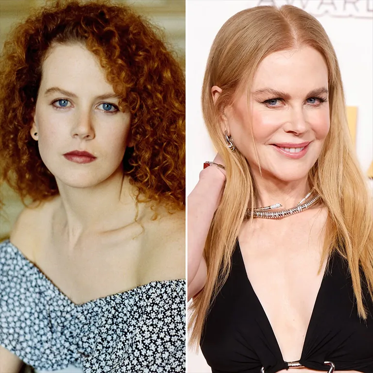 Nicole Kidman’s Skin Tightening Procedures