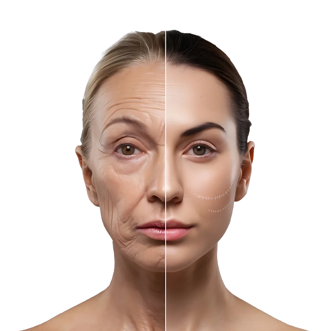 Advantages of Alloblast Treatment
