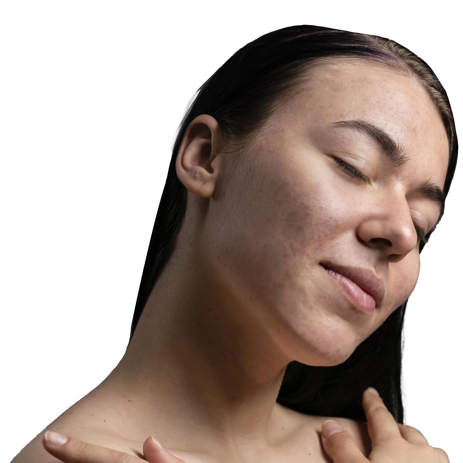 After HydraFacial
