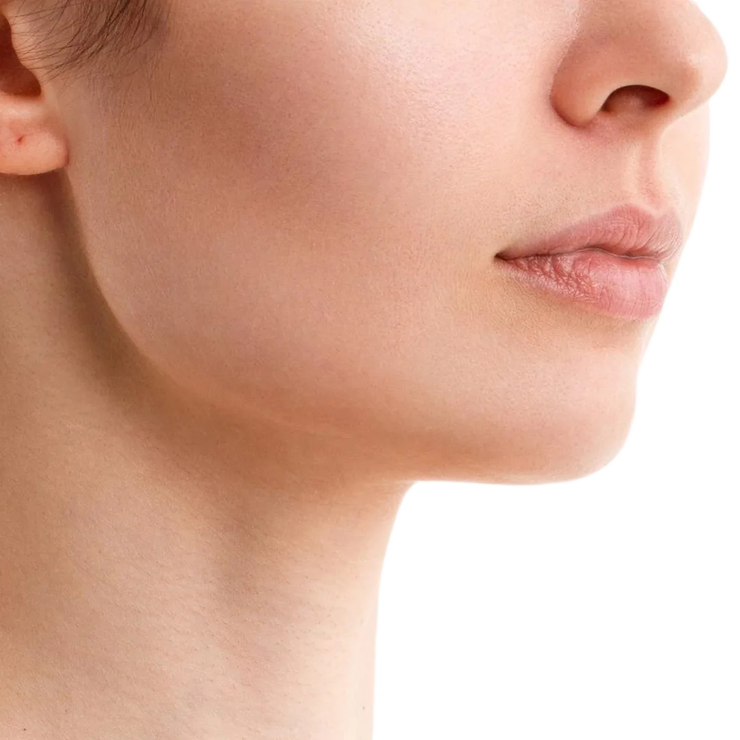 After Jawline