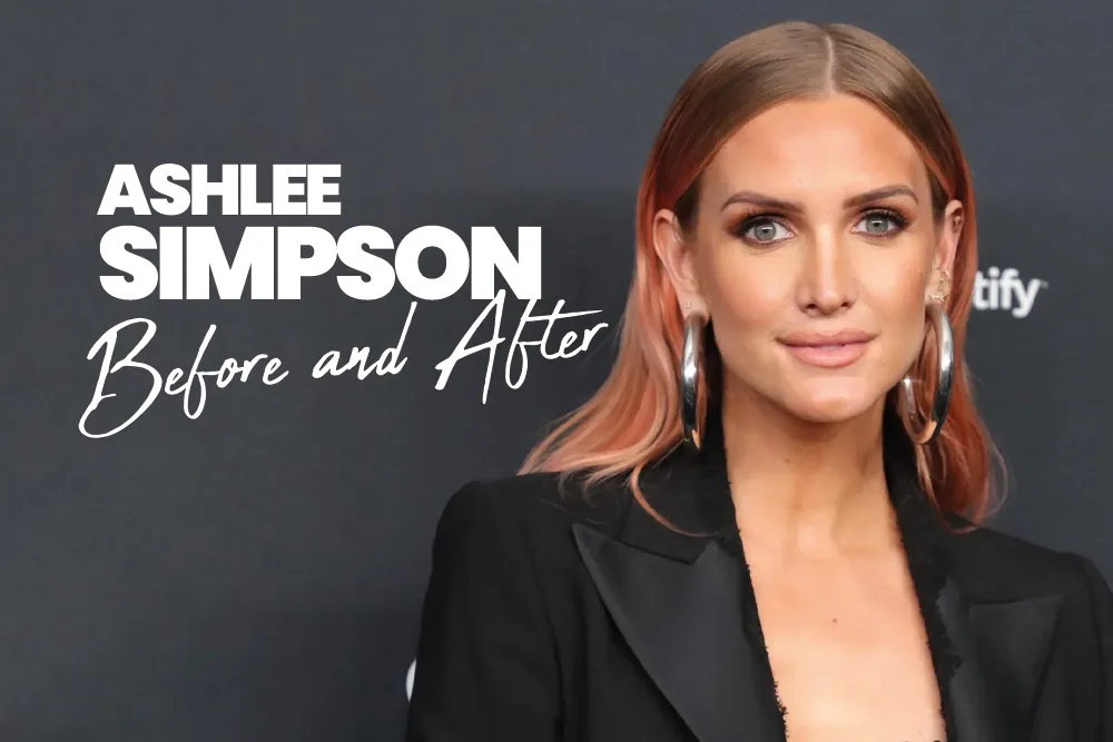 Ashlee Simpson Before and After