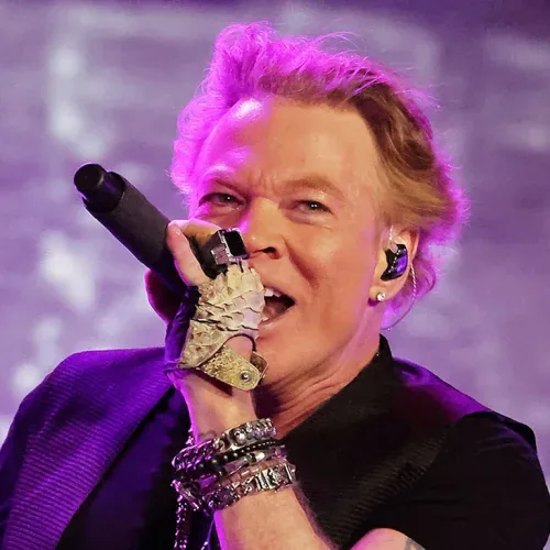 Axl Rose Aging Gracefully