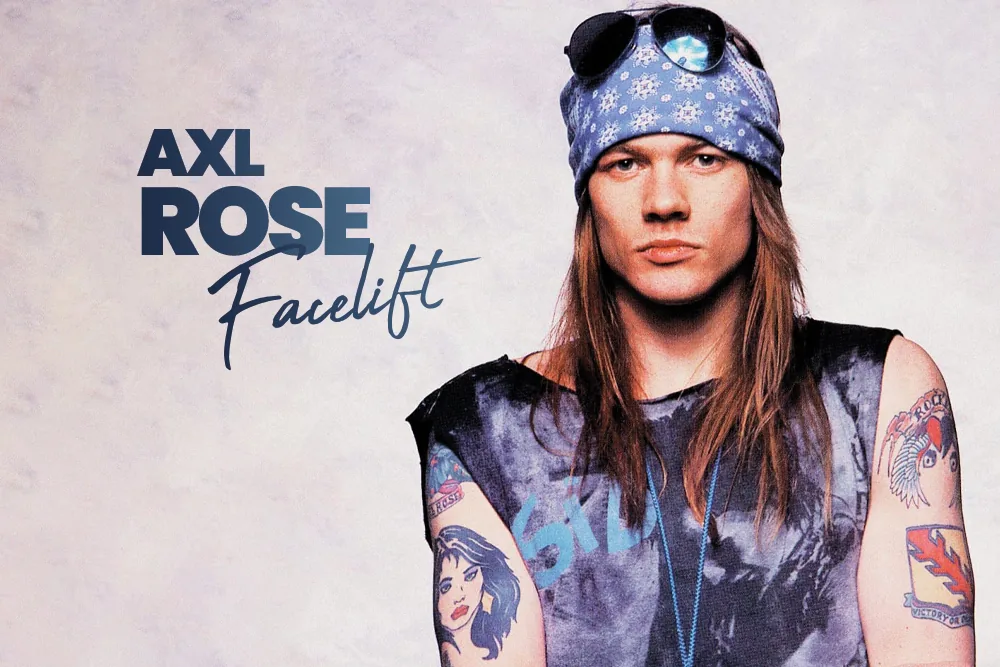Axl Rose Facelift