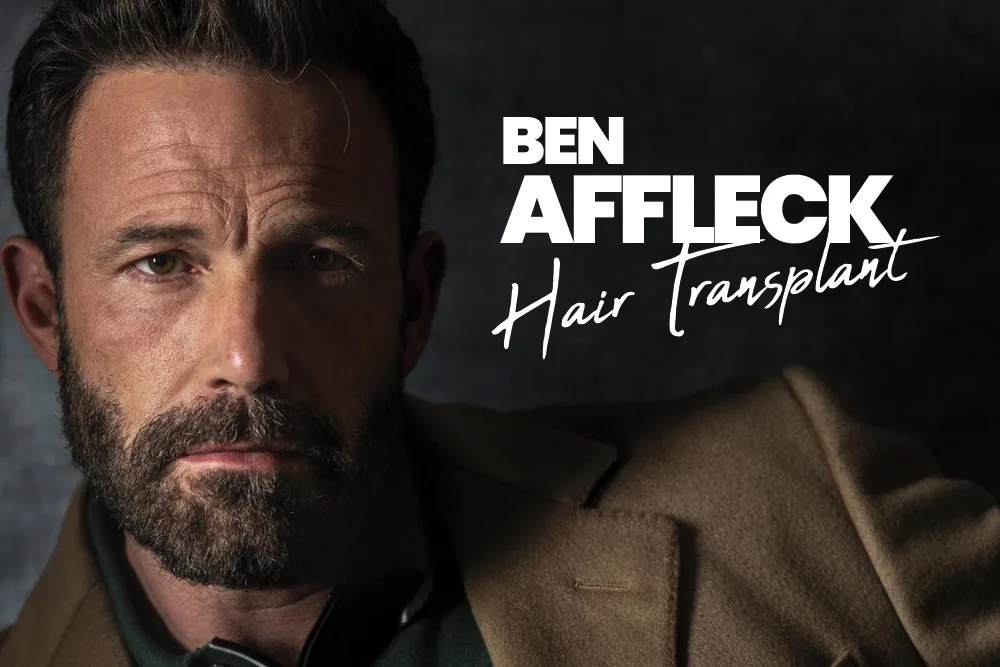 Ben Affleck Hair Transplant