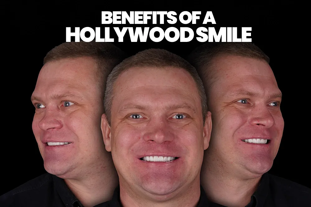 Benefits Of A Hollywood Smile