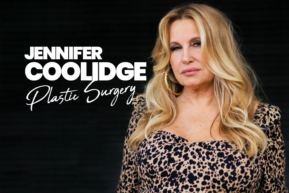 Jennifer Coolidge Plastic Surgery