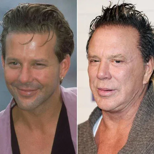 Mickey Rourke Before and After