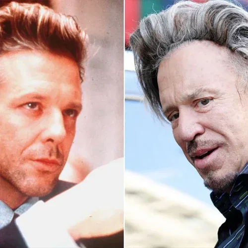 Mickey Rourke Aesthetic Transformation