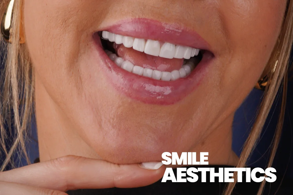 Smile Aesthetics
