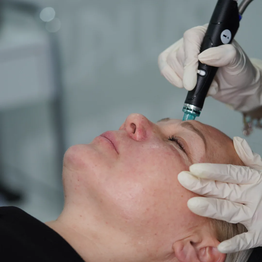 What is HydraFacial