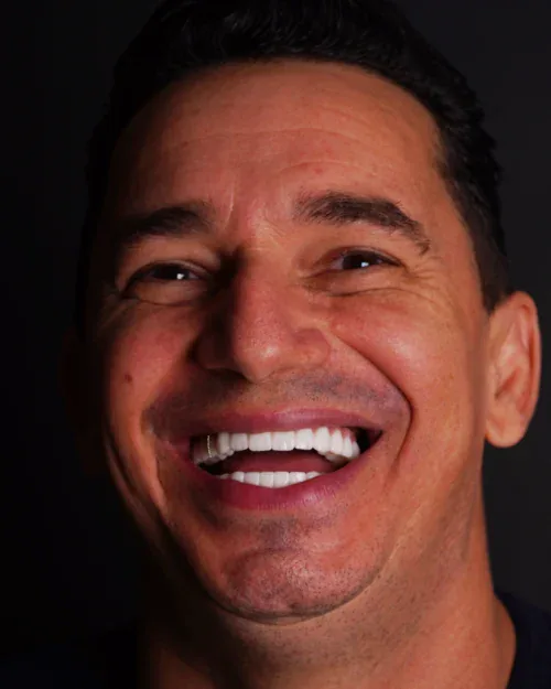 Is Hollywood Smile Permanent?