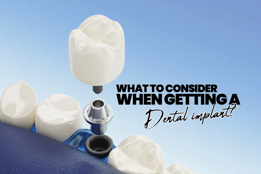 What to Consider When Getting a Dental Implant?