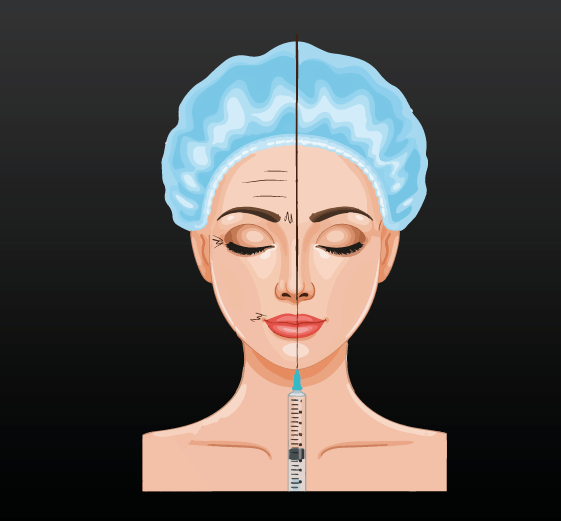 Botox
