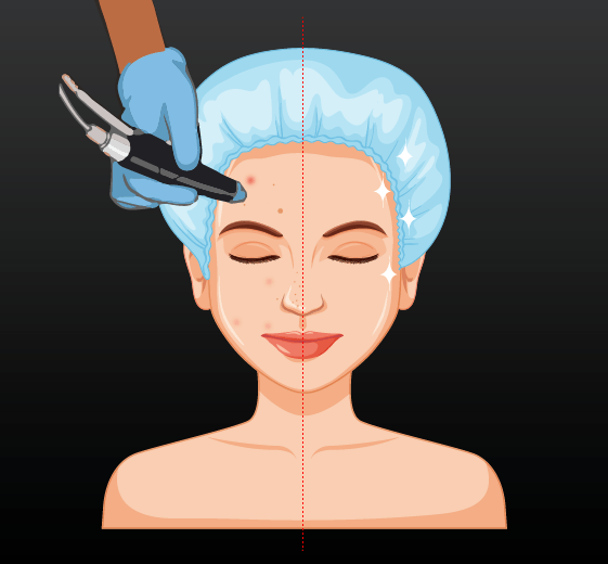 Hydrafacial
