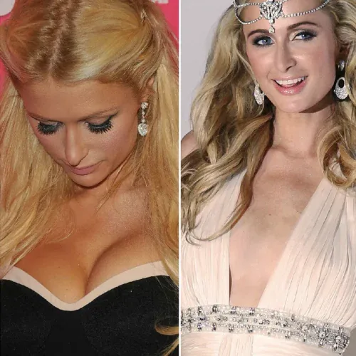 Paris Hilton’s Legacy: Redefining Beauty Through Aesthetics