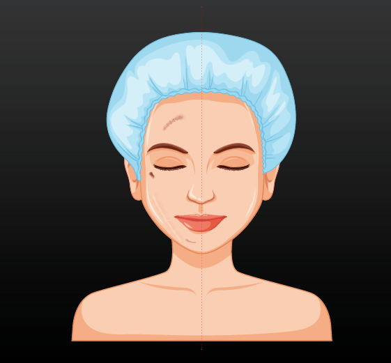 Pb Serum