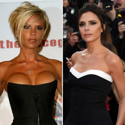 Victoria Beckham Before and After