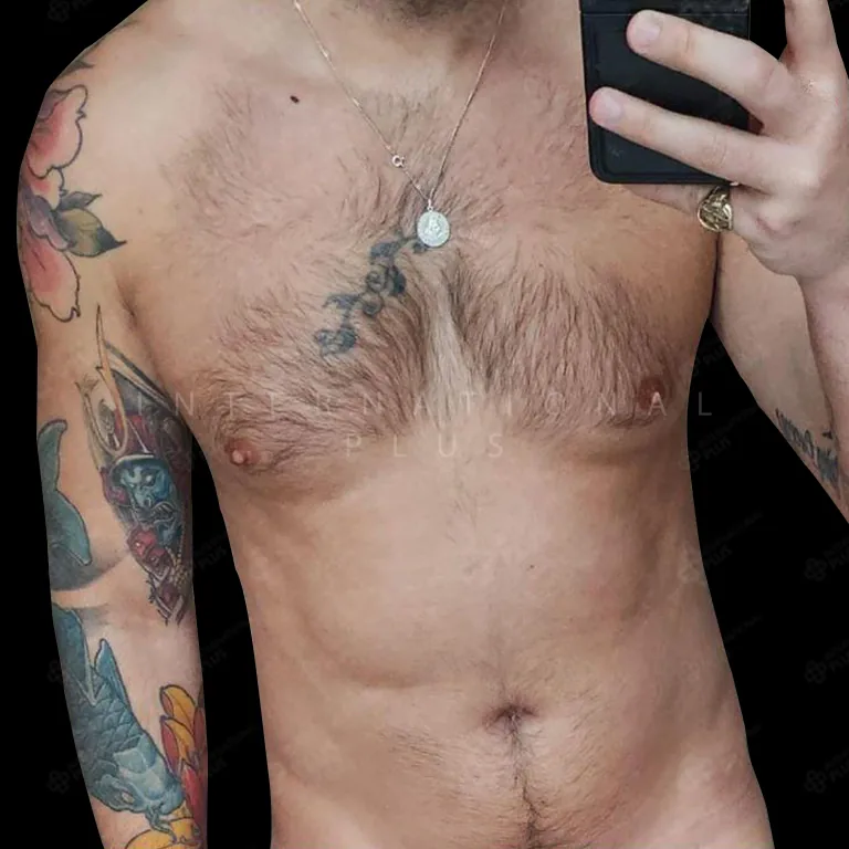 All Treatments Before After 1
