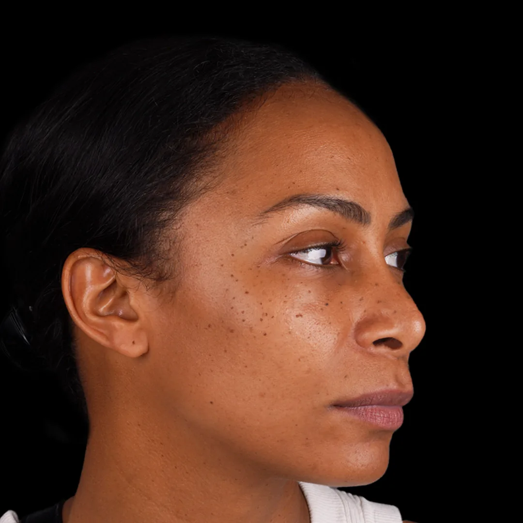 All Treatments Before After 21