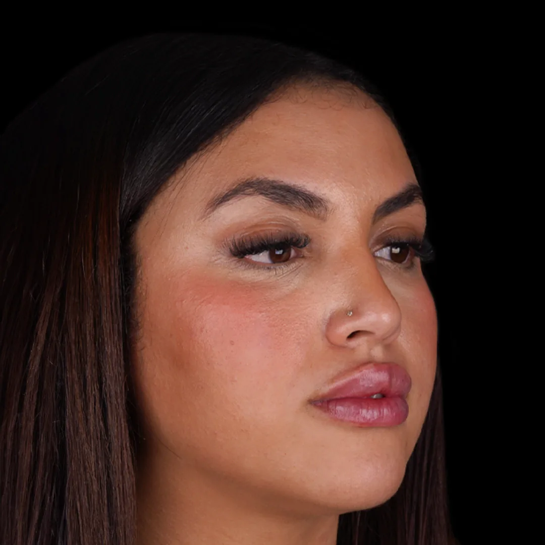 All Treatments Before After 24