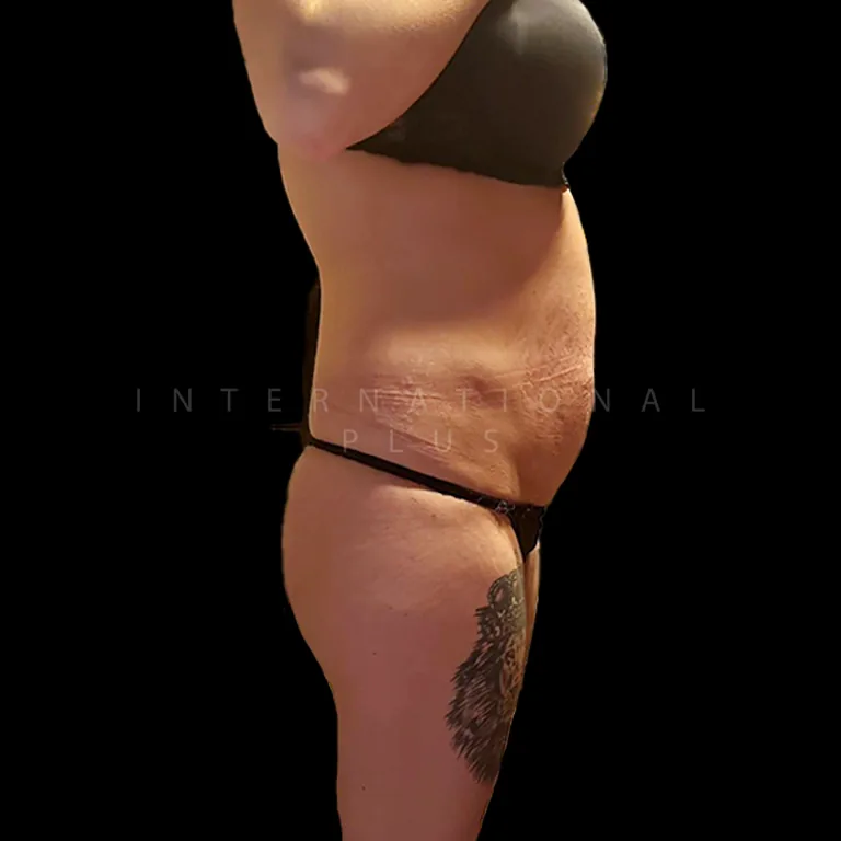 All Treatments Before After 25