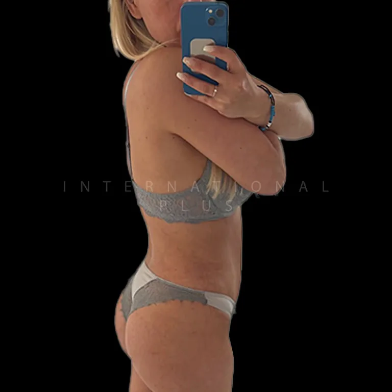 All Treatments Before After 26