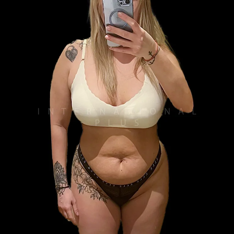All Treatments Before After 41