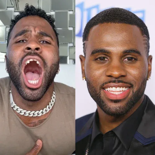 Jason Derulo Before and After